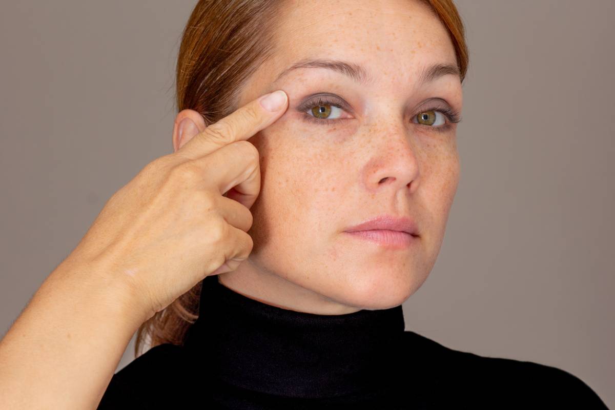 concept of woman looking at eyelids after bump removal