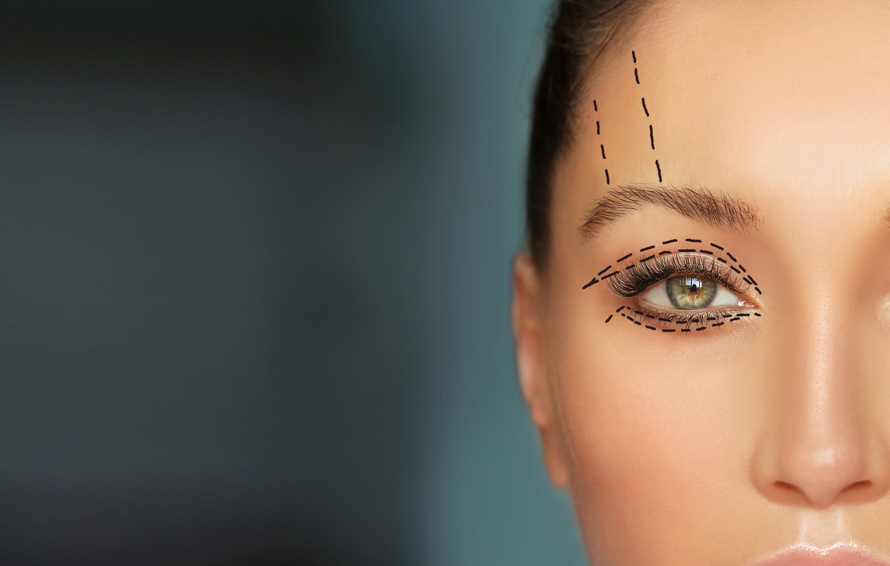 Featured image for Types of Cosmetic Eyelid Surgery