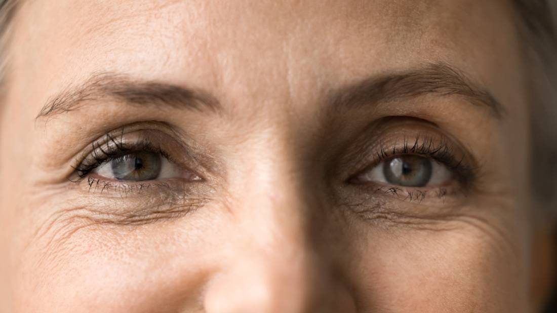 Featured image for Who Is an Ideal Candidate for Eyelid Surgery